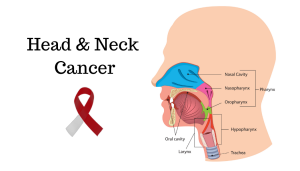 Headandneckcancers